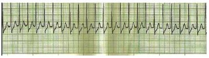 Simulado Cardiologia e Alterações Vasculares + imagem 1